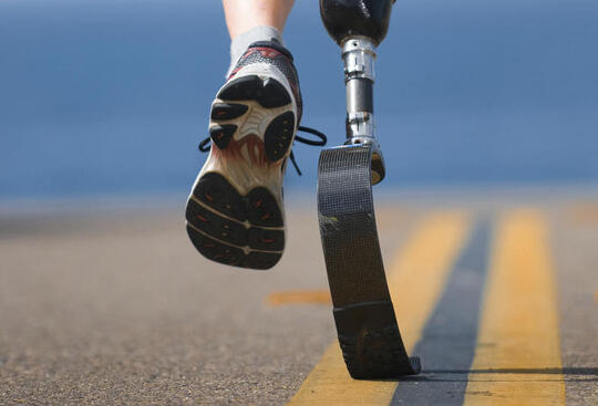 En fot med joggesko og en protese